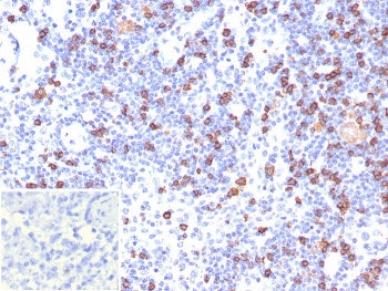 IHC staining of FFPE human lymph node tissue with CD8a antibody (clone CD8/7793R). Inset: PBS used i