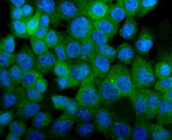 Immunofluorescent staining of FFPE human A431 cells with Integrin alpha 8 antibody (green) and DAPI 