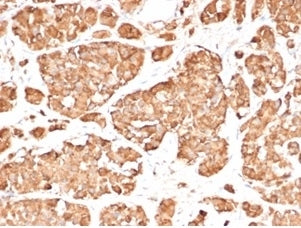 ACTH Antibody / Synacthen