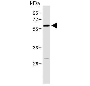 Western blot testing of human brain lysate with ROR alpha antibody. Predicted molecular weight ~59 k