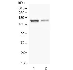 Western blot testing of human 1) HEK293 and 2) U-87 MG cell lysate with CRB1 antibody. Predicted molecular weight ~154 kDa.