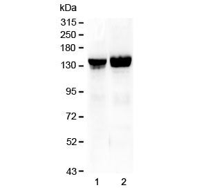 Western blot testing of 1) rat liver and 2) mouse liver lysate with Collagen II antibody at 0.5ug/ml