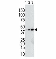 GST Antibody