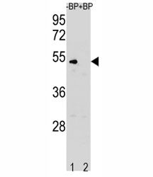 Cyclin B1 Antibody (CCNB1)