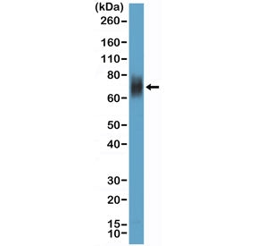 Recombinant CD33 Antibody