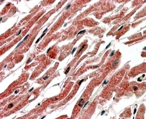 CPT1B Antibody
