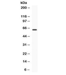 Western blot testing of human COLO320 cell lysate with TCF7L1 antibody. Expected/observed molecular 