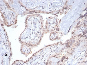 IHC staining of FFPE human pancreas tissue with SMAD4 antibody (clone SMAD4/7901). HIER: boil tissue