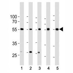 Western blot analysis of lysate from 1) HeLa, 2) K562, 3) MCF-7 cell line, 4) human liver and 5) mou
