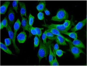 Immunofluorescent staining of FFPE human U-2 OS cells with HSC70 antibody (green) and DAPI nuclear s