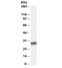 Western blot testing of rat brain lysate with Latexin antibody at 0.3ug/ml. Predicted molecular weig