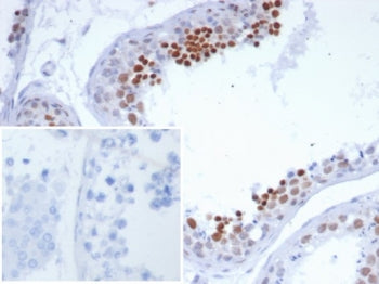NUTM1 Antibody / NUT family member 1