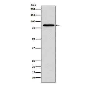 Western blot testing of human A431 cell lysate with Gelsolin antibody. Predicted molecular weight ~8