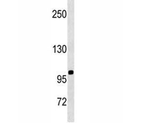 CD43 antibody western blot analysis in SK-BR-3 lysate. Predicted molecular weight 45-115 kDa dependi