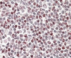 IHC testing of FFPE human tonsil with APOBEC3A antibody at 4ug/ml. HIER: steamed with pH6 citrate bu
