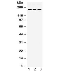 Western blot testing of 1) rat brain, 2) human HeLa, and 3) mouse NIH3T3 lysate with PDGFR alpha ant