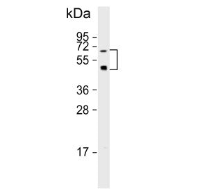 Western blot testing of human HepG2 cell lysate with OASIS antibody. Predicted molecular weight ~57 