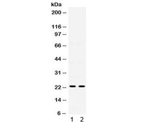 Western blot testing of human 1) U20S and 2) HeLa lysate with IGFBP5 antibody. Expected molecular we