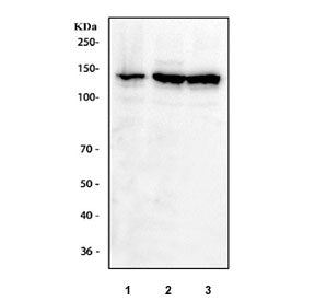 IFNAR1 Antibody / Interferon alpha receptor 1