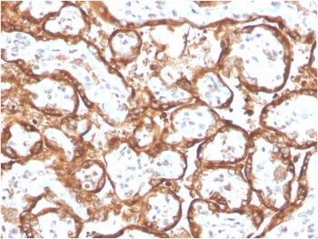 hCG alpha Antibody / Luteinizing Hormone alpha