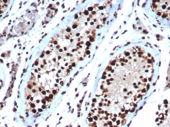 HSP70 Antibody / HSPA1B