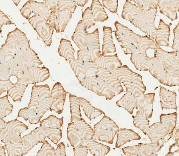 IHC staining of FFPE human skeletal muscle tissue with PFKFB4 antibody. HIER: steam section in pH6 c