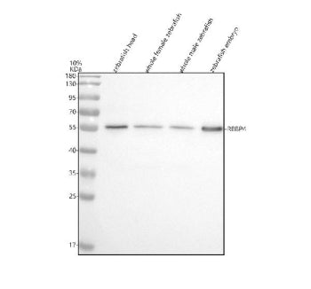 Western blot analysis of Rbbp4 protein using Zebrafish Rbbp4 antibody and 1) zebrafish head, 2) whol