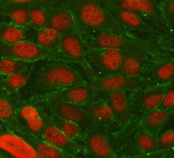 TRIM36 Antibody