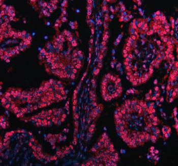 Immunofluorescent staining of PRDM11 using anti-PRDM11 antibody (red). PRDM11 was detected in a para