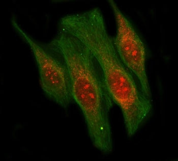 Immunofluorescent staining of FFPE human HeLa cells with LIN9 antibody (red) and Beta Tubulin mAb (g