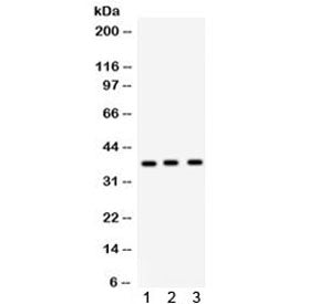 Surfactant protein D Antibody