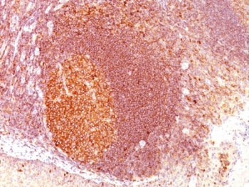 MALT1 Antibody