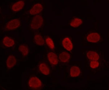 Immunofluorescent staining of FFPE human HeLa cells with LRIG2 antibody (red).