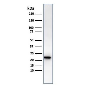 FTL Antibody / Ferritin Light Chain