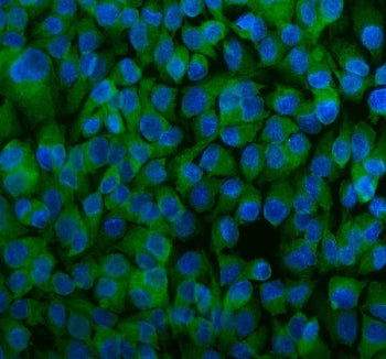 Immunofluorescent staining of FFPE human SK-O-V3 cells with DJ-1 antibody (green) and DAPI nuclear s