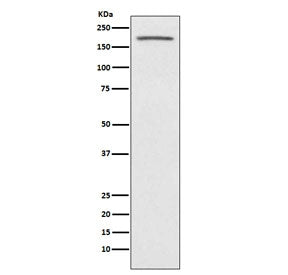 Western blot testing of human fetal kidney lysate with ACE antibody. Predicted molecular weight: 140