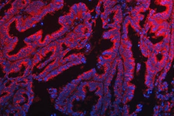 TTC7B Antibody / Tetratricopeptide repeat protein 7B