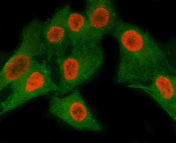 Immunofluorescent staining of FFPE human A549 cells with Matrin 3 antibody (red) and Beta Tubulin mA