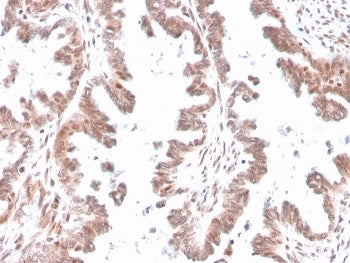 IHC staining of FFPE human ovary with GDF9 antibody. HIER: boil tissue sections in pH 9 10mM Tris wi