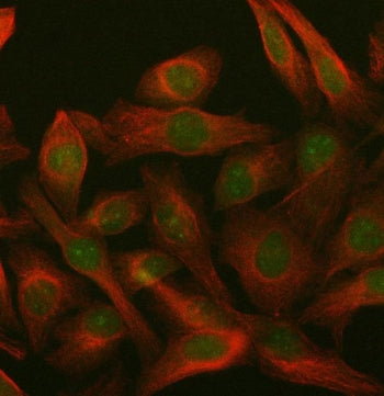 Immunofluorescent staining of FFPE human HeLa cells with PARP3 antibody (green) and Beta Tubulin mAb