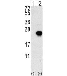 Western blot analysis of FGF1 antibody and 293 cell lysate (2 ug/lane) either nontransfected (Lane 1