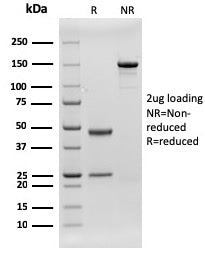 SDS-PAGE analysis of purified, BSA-free recombinant CD79b antibody (rIGB/1842) as confirmation of in
