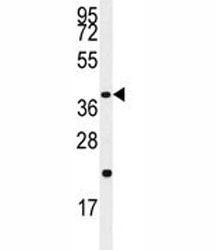 Caspase-9 Antibody