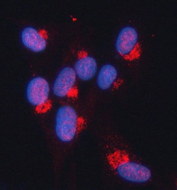 Snurportin 1 Antibody / SNUPN