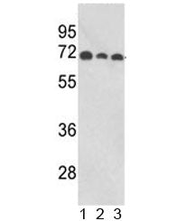 ABI1 Antibody / SSH3BP1
