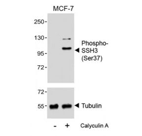 Western blot analysis of lysates from the human MCF7 cell line, untreated or treated with Calyculin 
