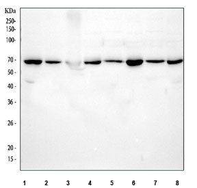 Western blot testing of 1) human SiHa, 2) human HeLa, 3) human RT4, 4) human A549, 5) rat brain, 6) 