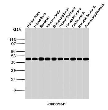 Western blot analysis of Human Brain, Mouse Brain, Rat Brain, Hamster Brain, Guinea pig Brain, Human