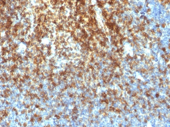 IHC testing of FFPE human tonsil with recombinant CD43 antibody (clone SPN/1766R). Required HIER: bo