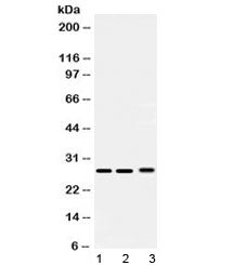 PSMA3 Antibody / Proteasome 20S alpha 3
